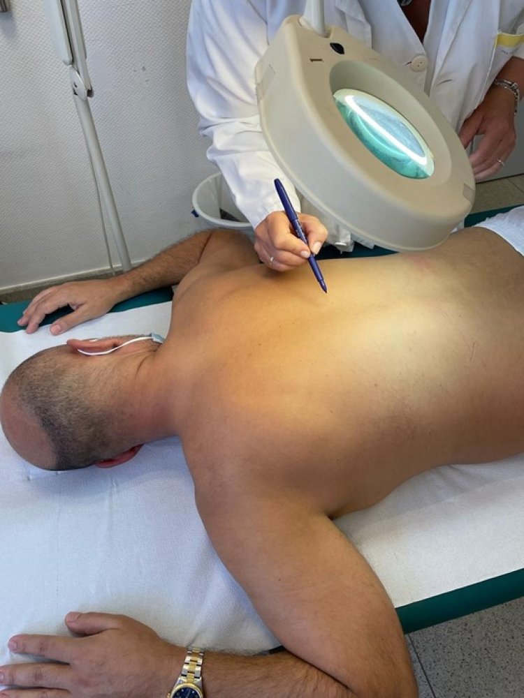 Salud recomienda la autoexploración frecuente para la prevenir el melanoma